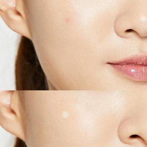 COSRX Acne Pimple Master Patch