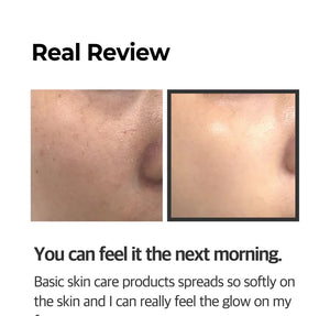 Some By Mi Aha 10% Amino Peeling Ampoule Momento De Aplicación Noche Tipo De Piel Mixta