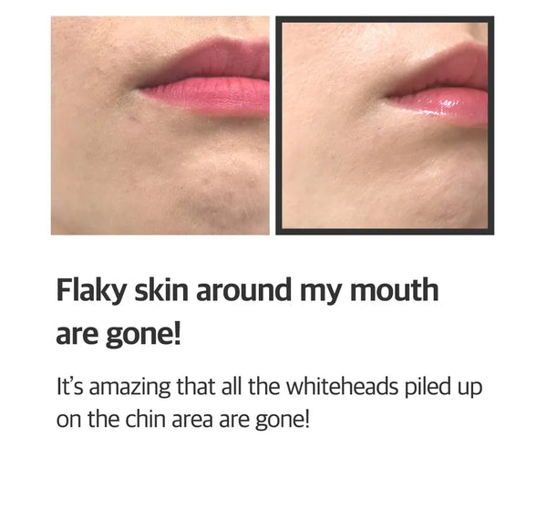 Some By Mi Aha 10% Amino Peeling Ampoule Momento De Aplicación Noche Tipo De Piel Mixta