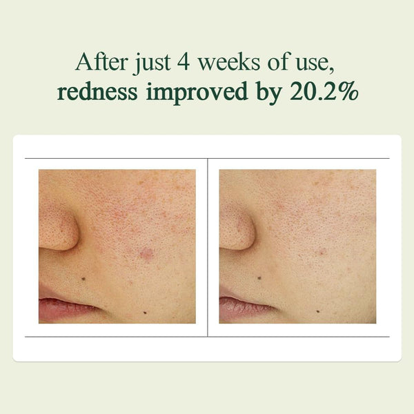 Pyunkang Yul Crema Facial Calmante Madecasoside 30ml