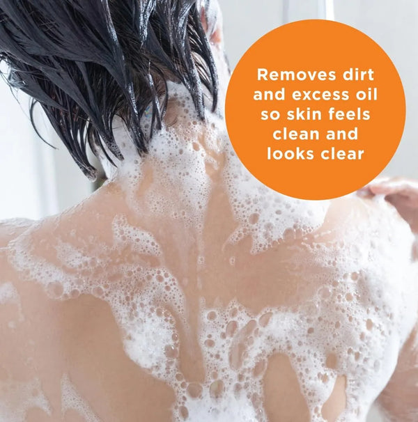 Panoxyl Jabón En Barra Barra - 1 pieza de 113 G